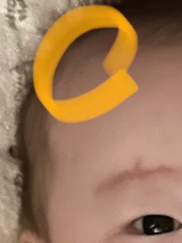아기가 잘 때 한쪽 머리만 긁어요