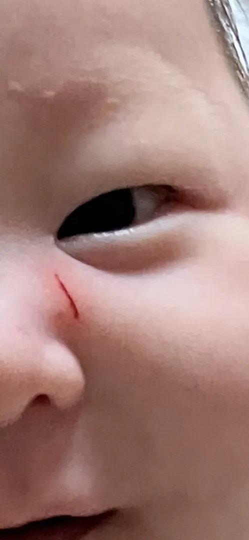 악 ㅠㅠ 또 긁었어요 ㅠ