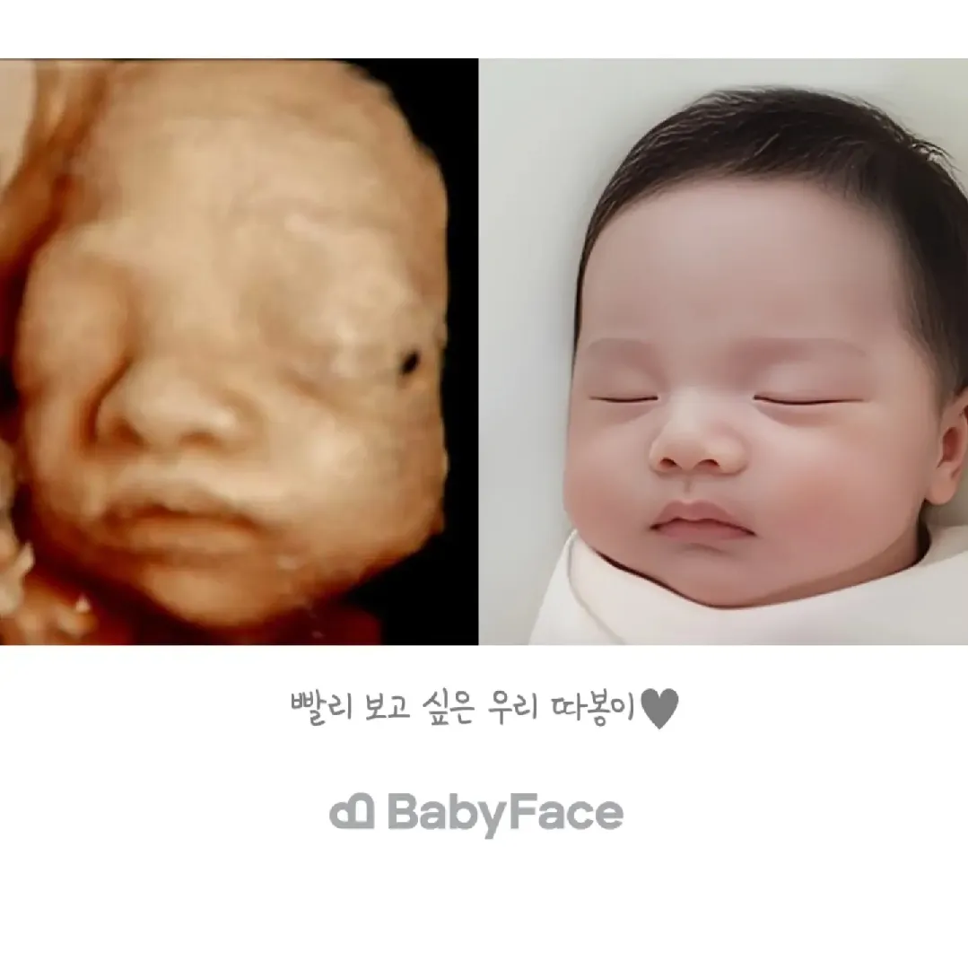 입체초음파 베이비페이스 왔어요!