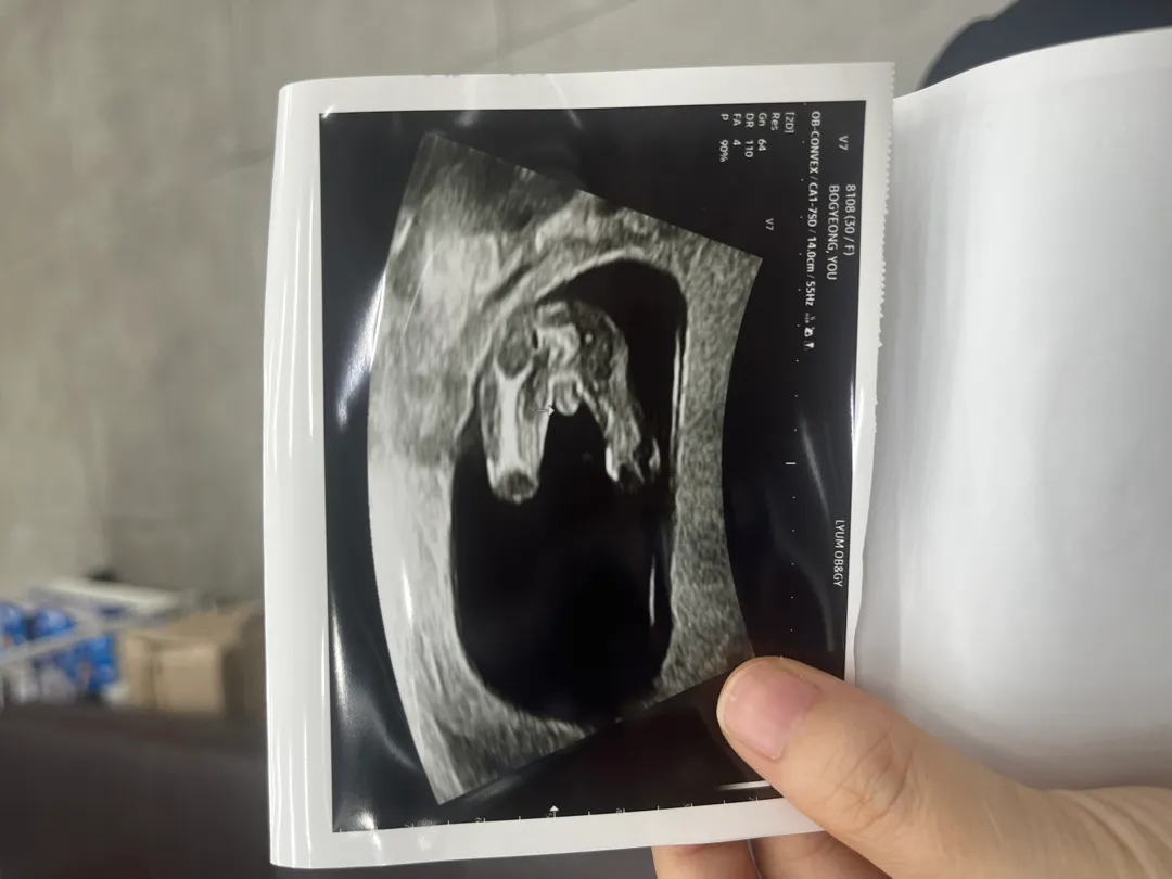 이정도면 아들 빼박인거죵??