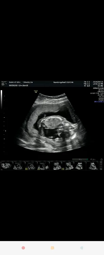 16주 1일 아들맘 확정이요ㅎㅎㅎ