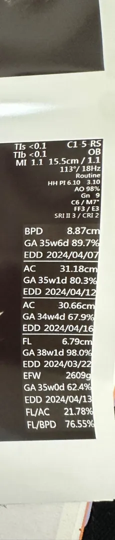 34주차 애기가 너무 잘크다는데 너무 큽니다..