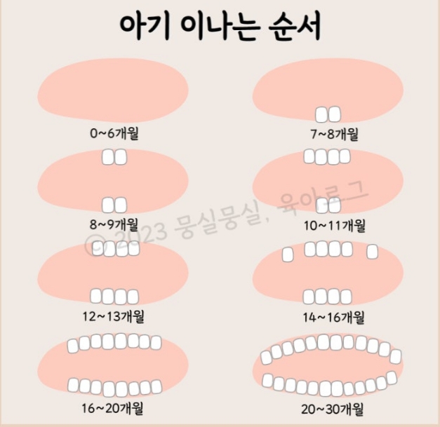 유치가 순서대로 안나는 경우도 있나요?