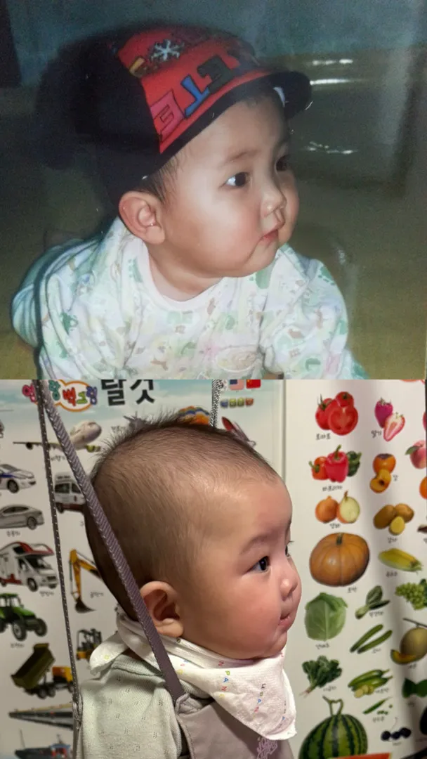 얼굴변화