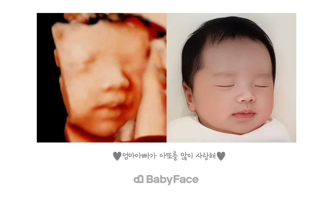 입체초음파 찍으신분들 !!! 베이비페이스도 자랑해주세요 !