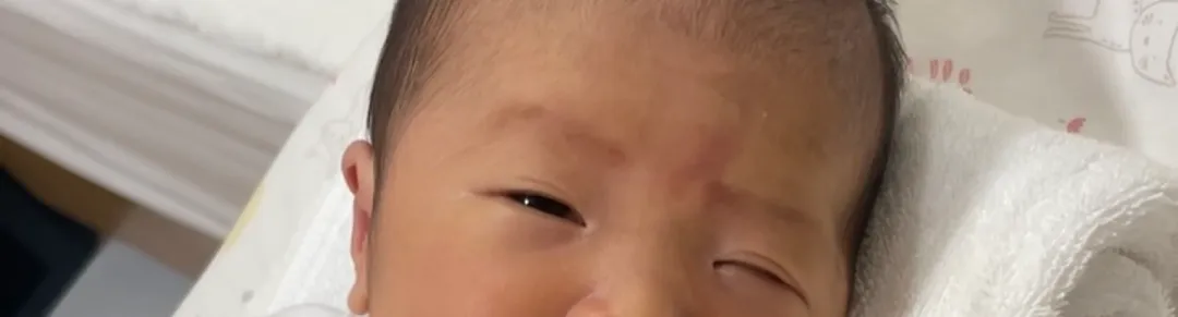 신생아 쌍커플,,,질문이요!!!