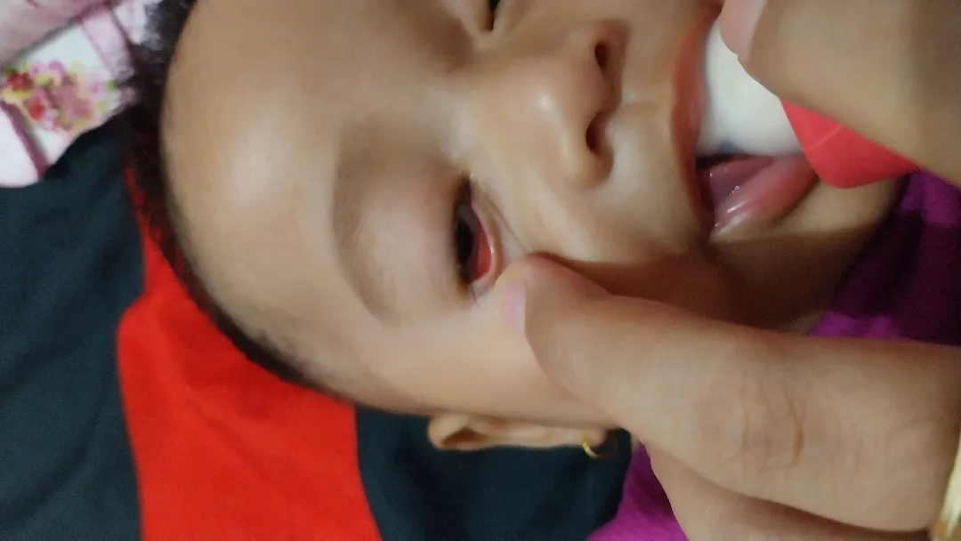 Sakit mata bayi 