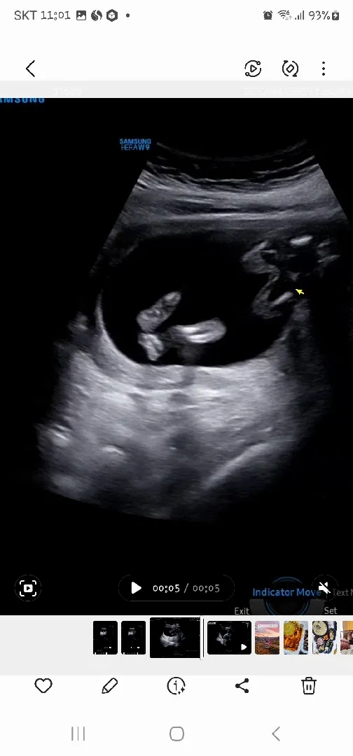 16주 5일 딸이래요^^