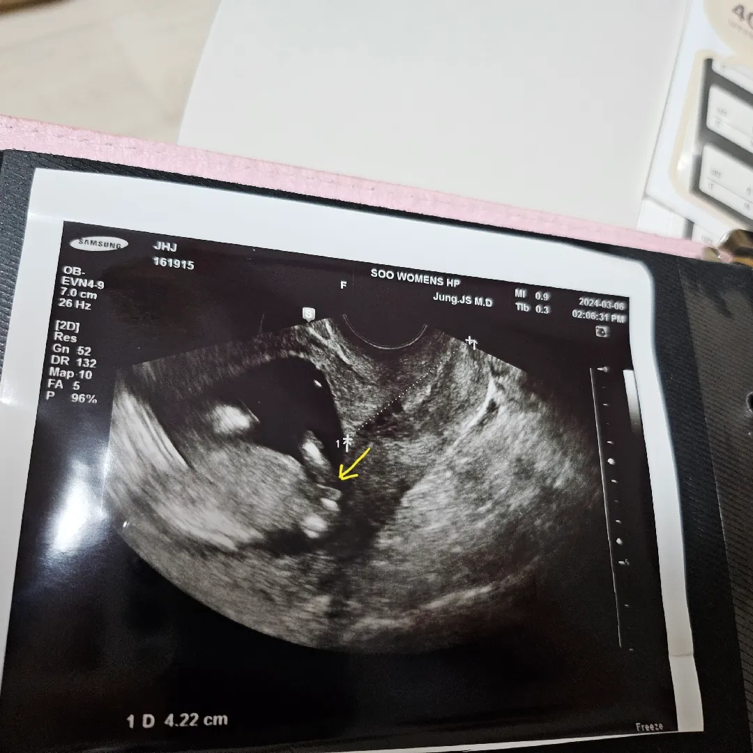 이거 혹시 🌶일까요?