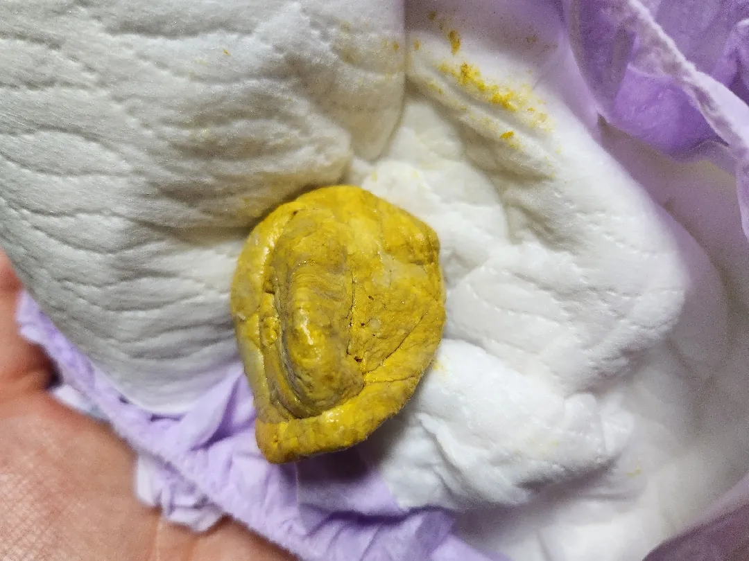 완분하는 백일아가. 응가 괜찮나요??