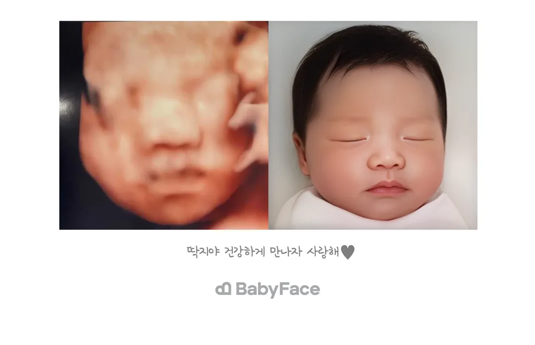 베이비페이스