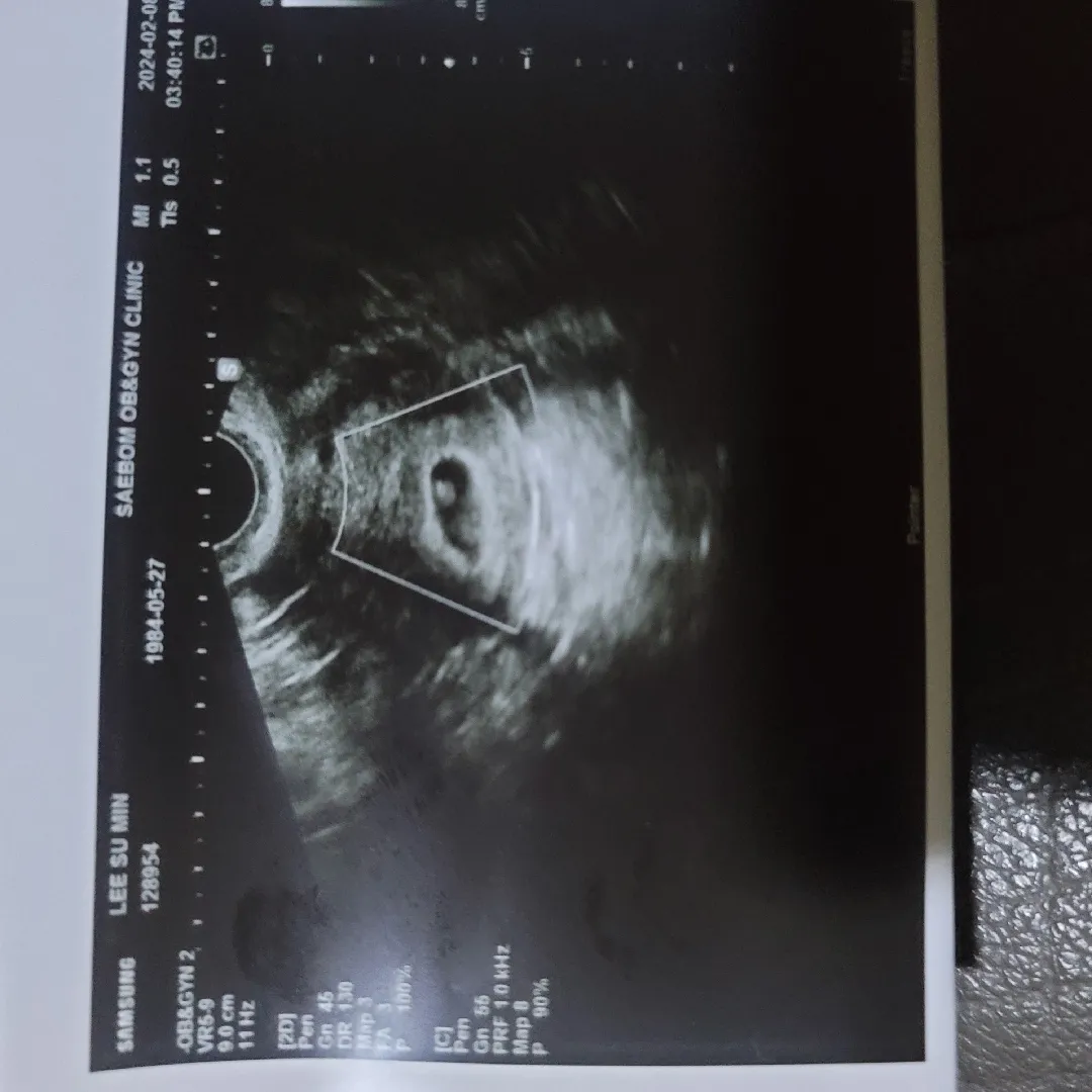 어제 오늘 기분이 하늘과 땅끝입니다!!!!!