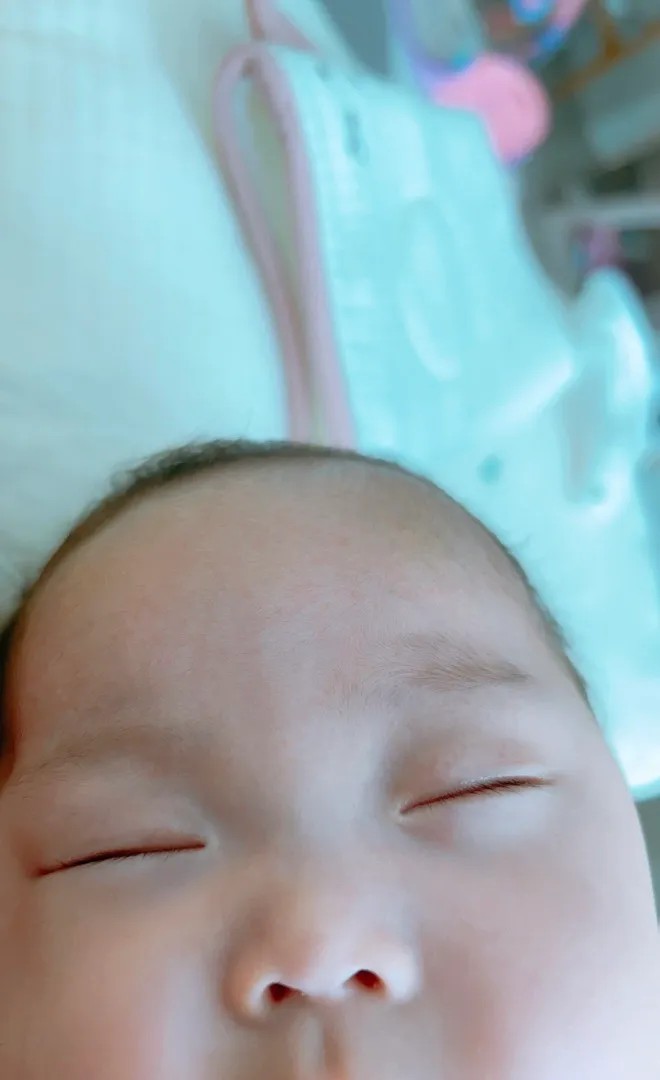 이마에만 좁쌀 여드름?? 