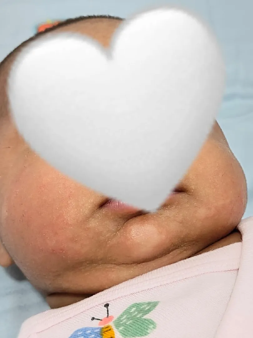 KULIT BAYI