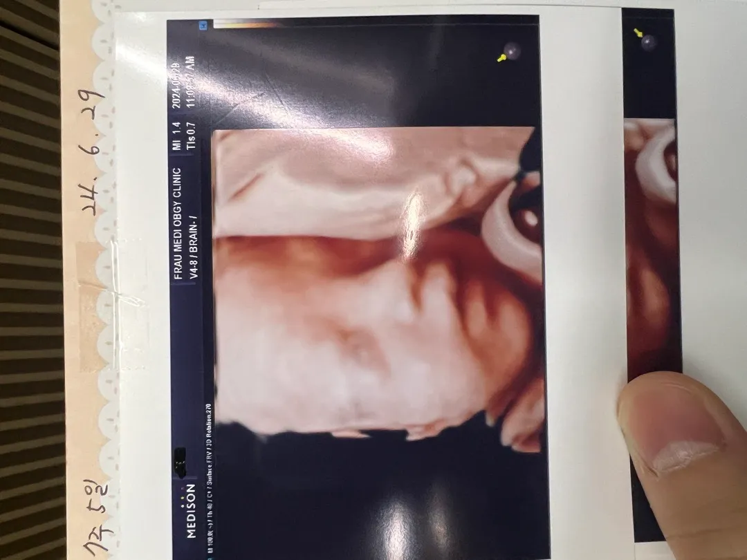 초X에몽 먹고 입초 성공했어요