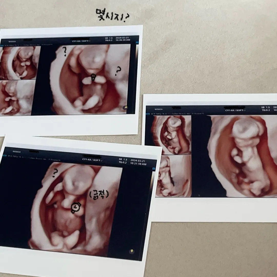 12주 5일차 입체초음파 포즈 ㅎㅎ