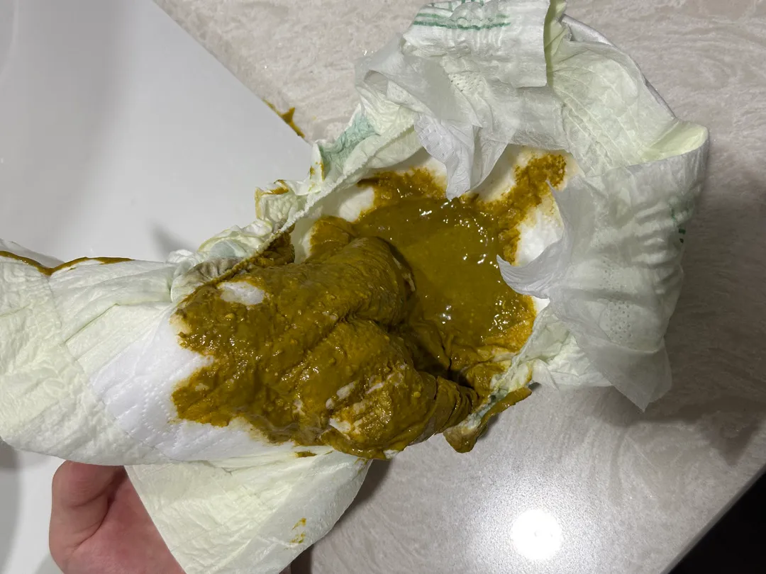 변 사진 좀 봐주실 분 계실까요? 사진O