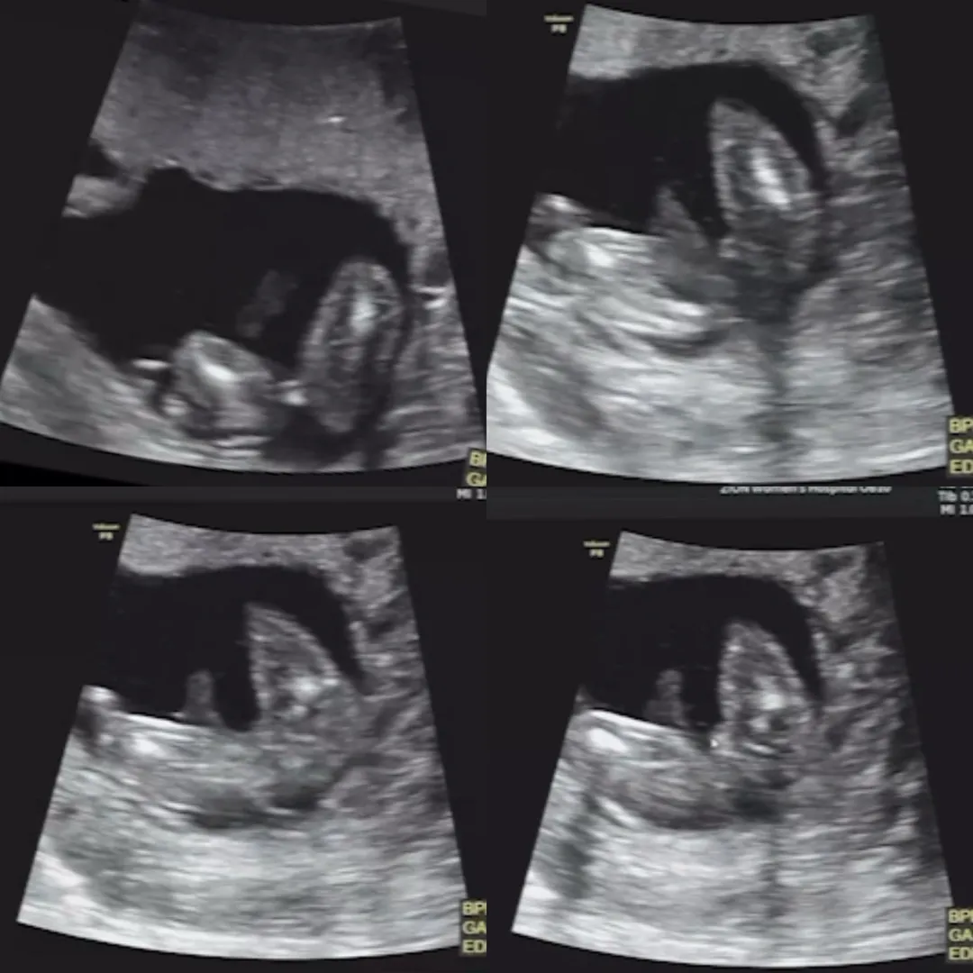 16w 1d 공주님일까요? 🥹
