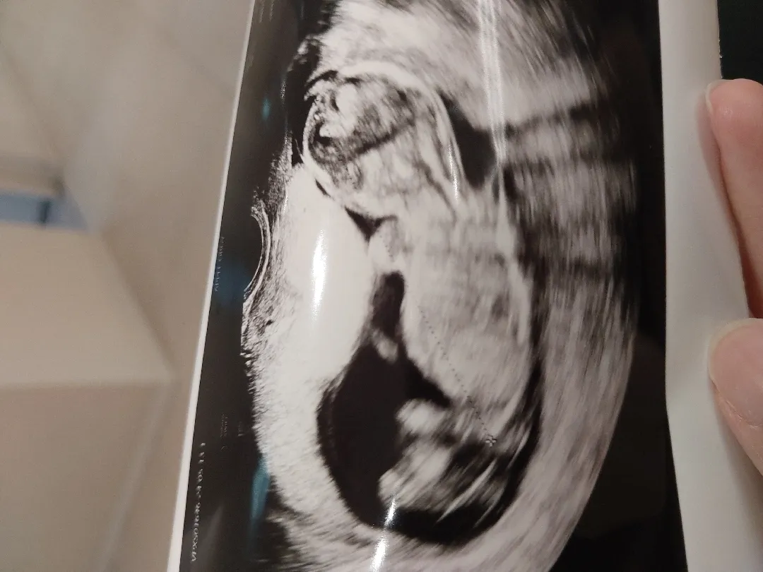 14주4일 각도법 알수잇을까요