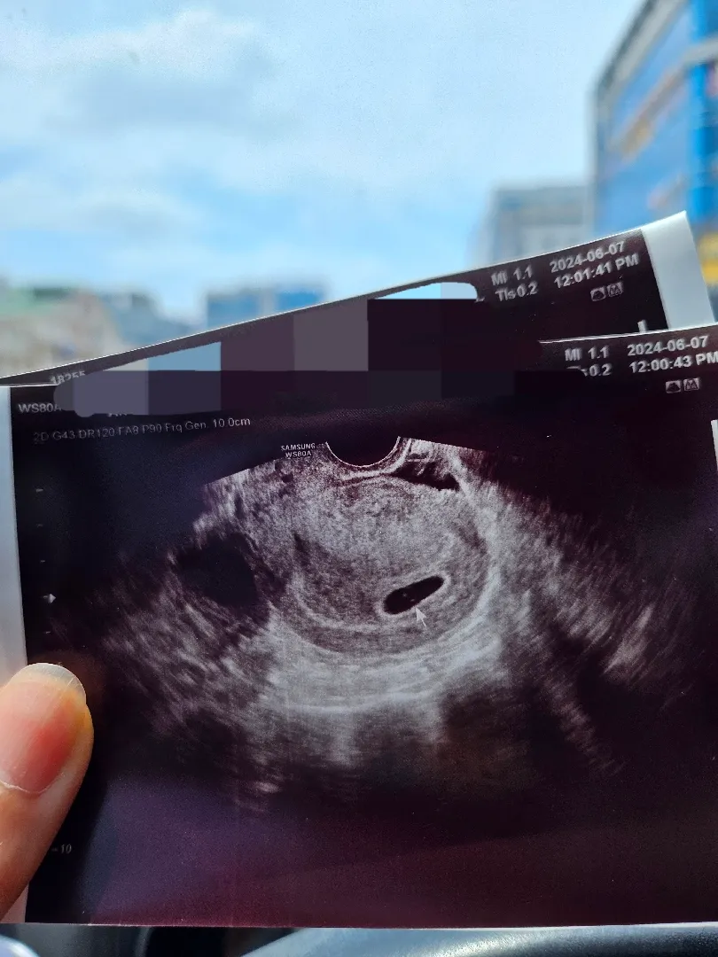 촘파 또 보고 왔어요!