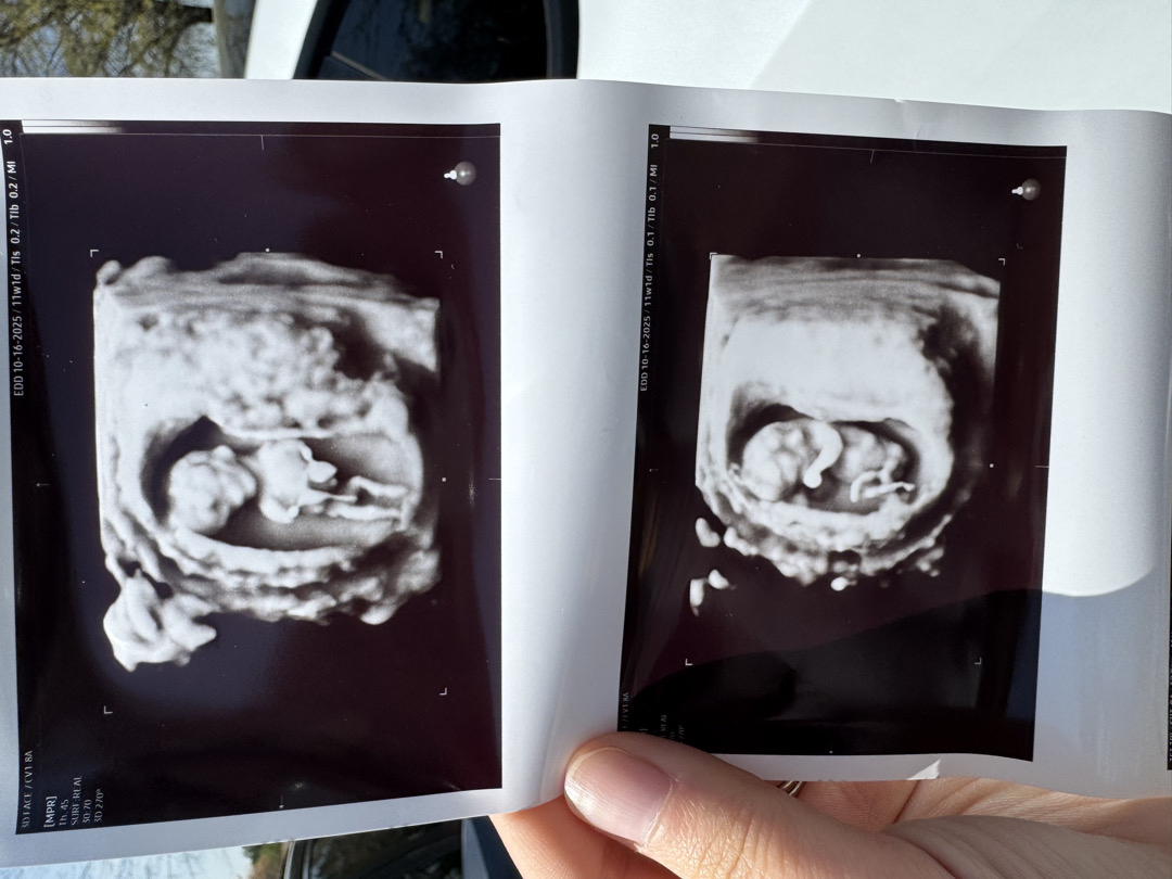 11주 1일차 춈파