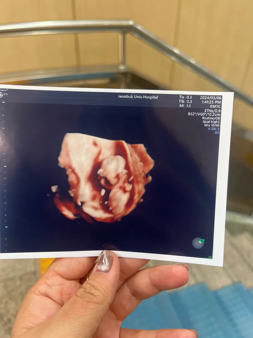 각도법 봐주세요 ㅠㅠㅠ