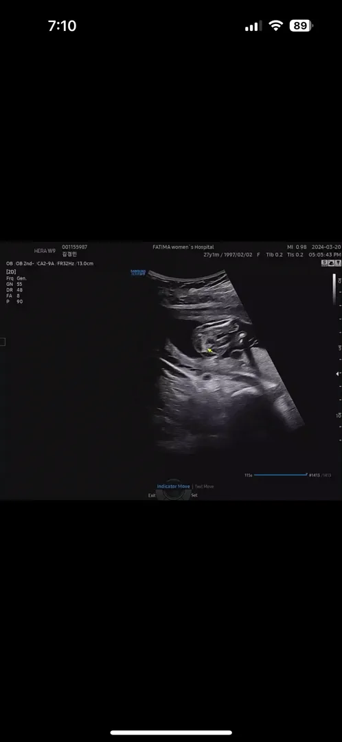 이거 꼬추일까여?