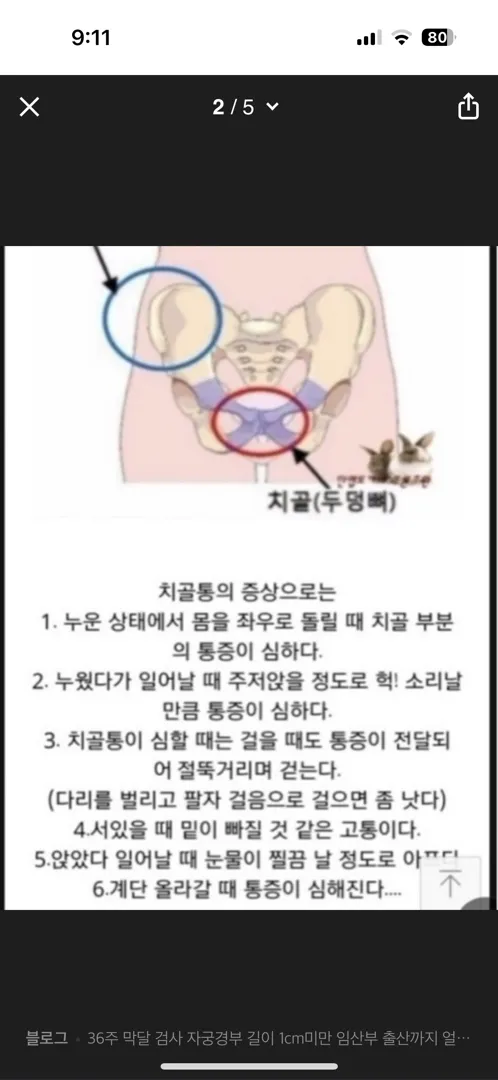 와 치골통