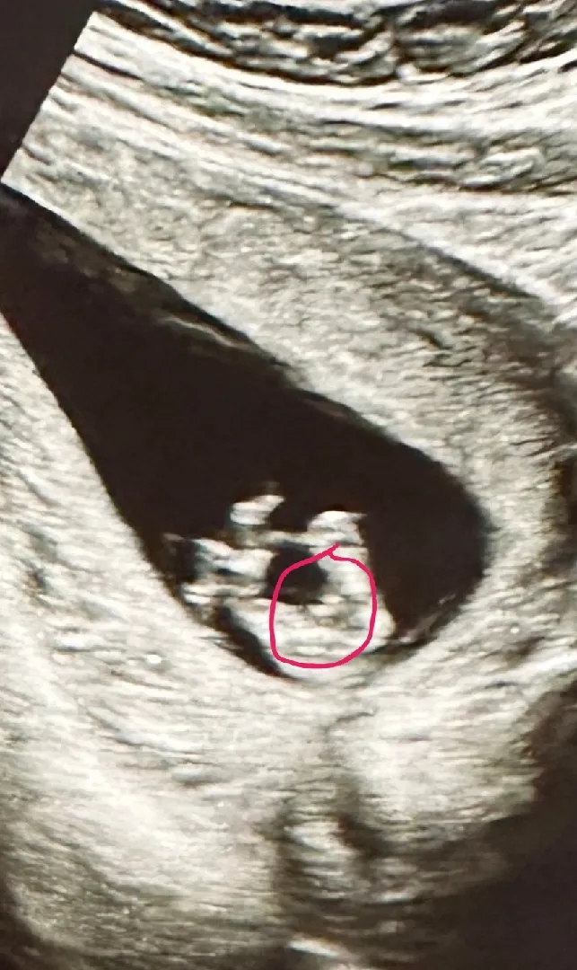설마 저 동그라미 두개 남자인가요 ?