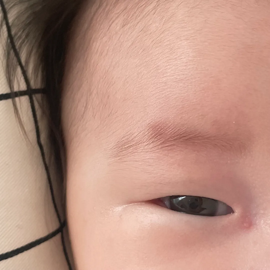 3개월 아기 눈앞머리쪽에 비판텐 발라도 될까요??