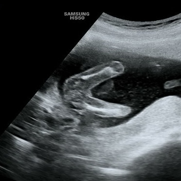 16주 5일 성별 반전 없겠죠?