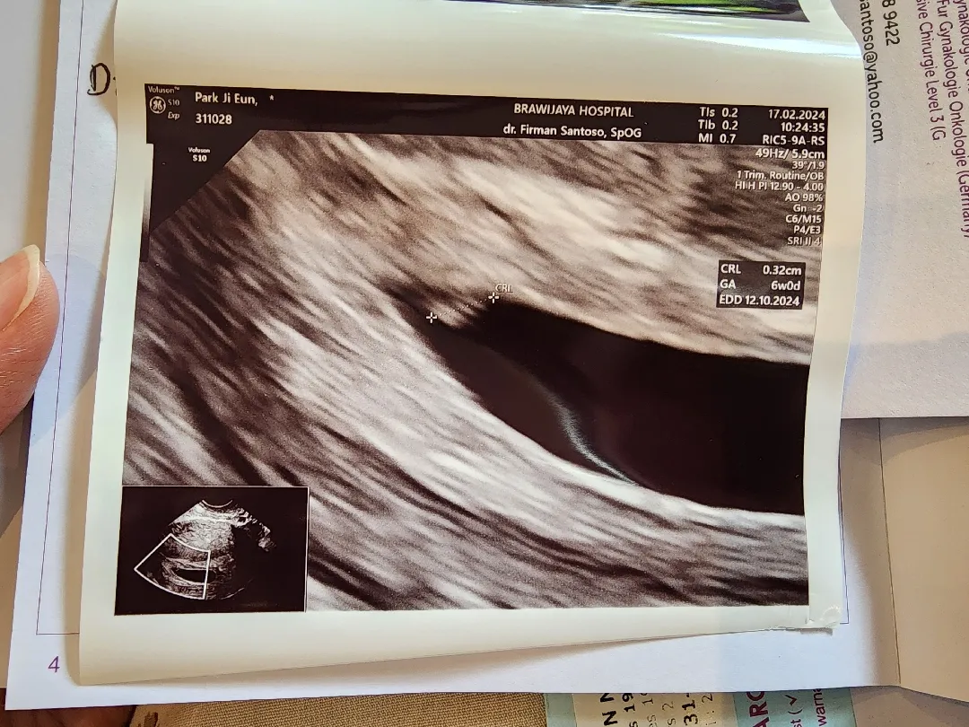 6주 0일! 애기 심장 반짝이는거 보고 왔어요~♡