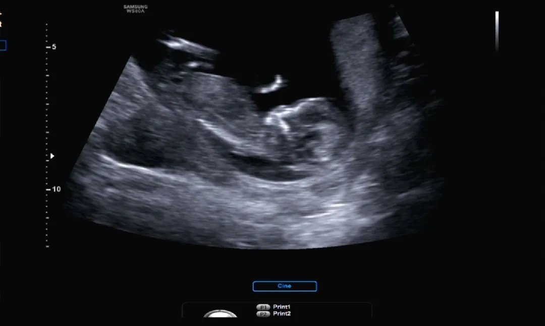 12주 각도법 봐주실분!!