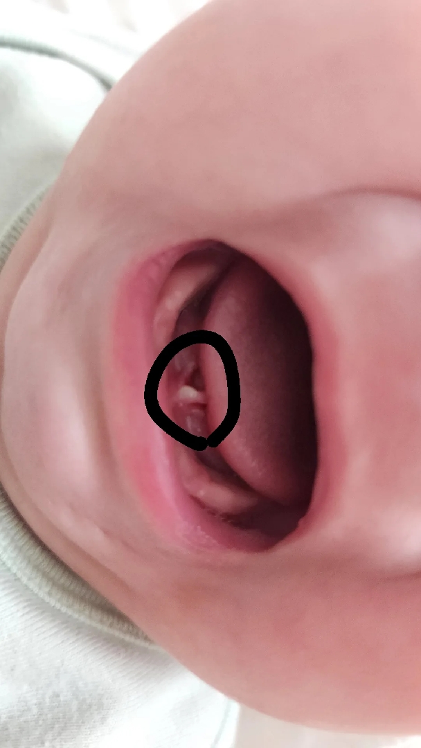 진주종?