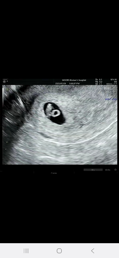 7주1일 심소듣고왔어요!!!