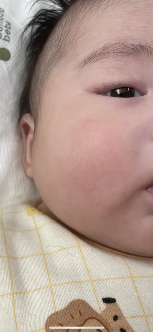 이런피부 뭘까요
