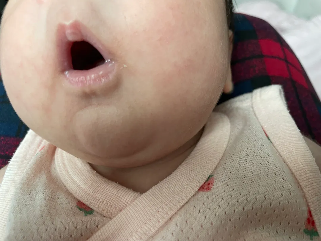 이거 태열맞나요...