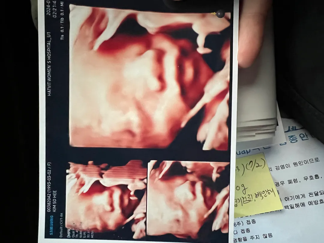 입초찍구왔어용