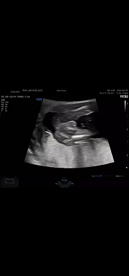 community post image