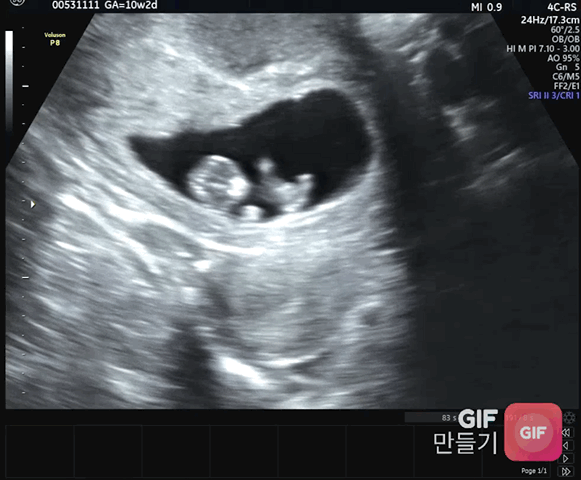 활발한 용키♥︎ 아빠입니다😎