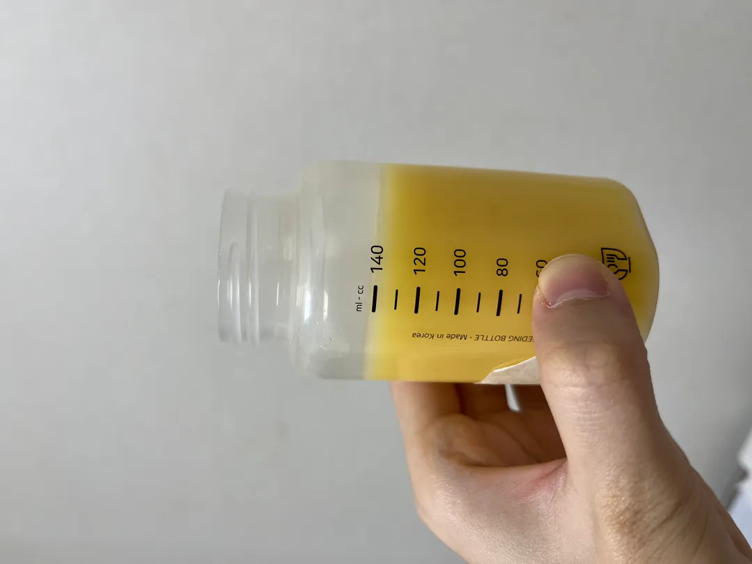 제왕절개 4일차 초유양 140ml