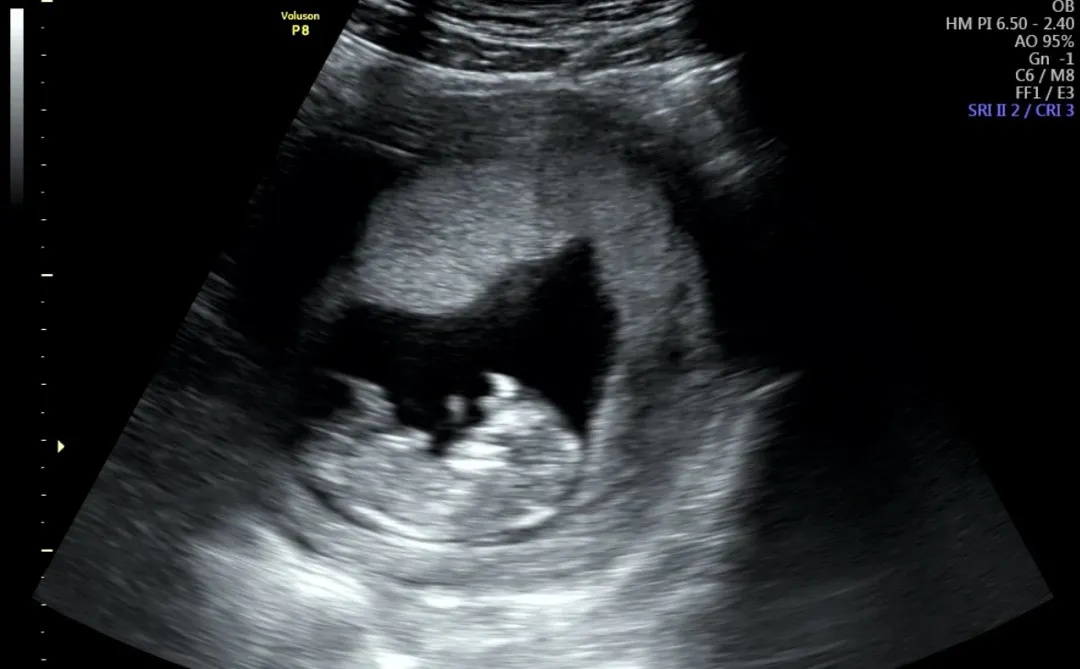 community post image