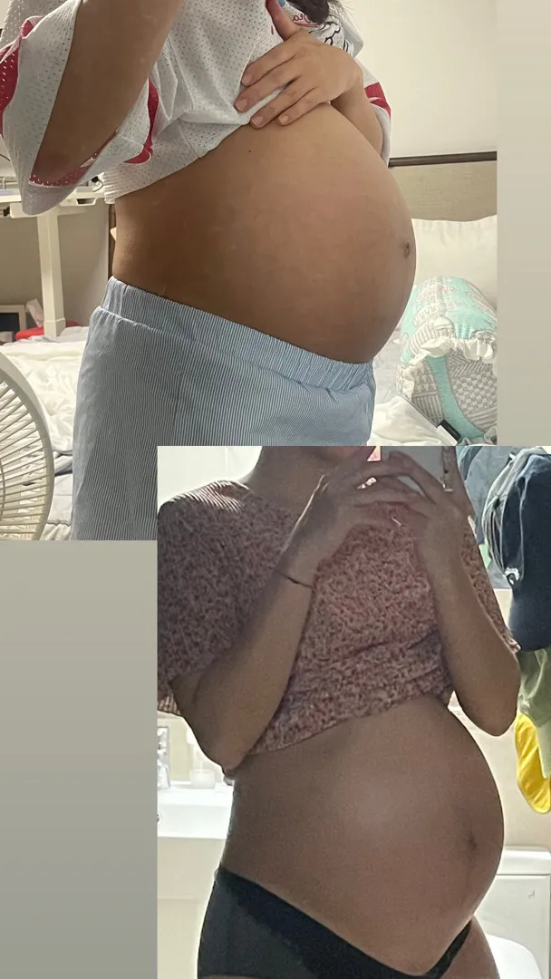 막달까지 변비인데 어떡하죠ㅠㅠ