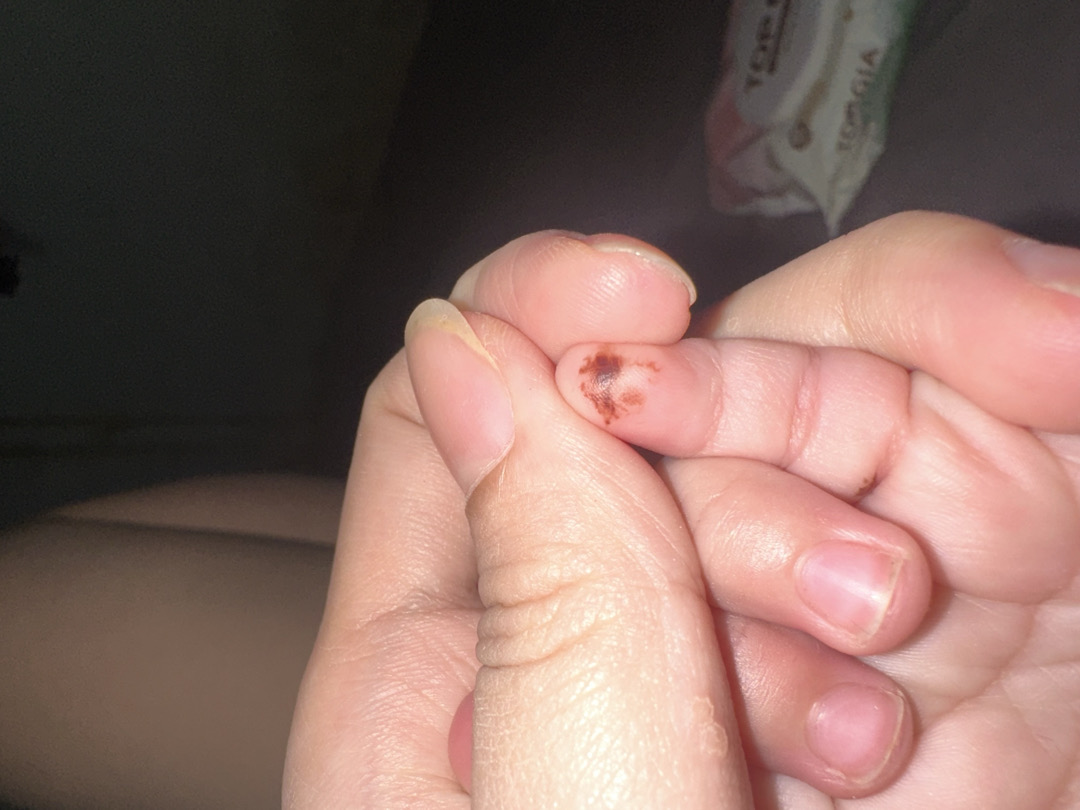 community post image