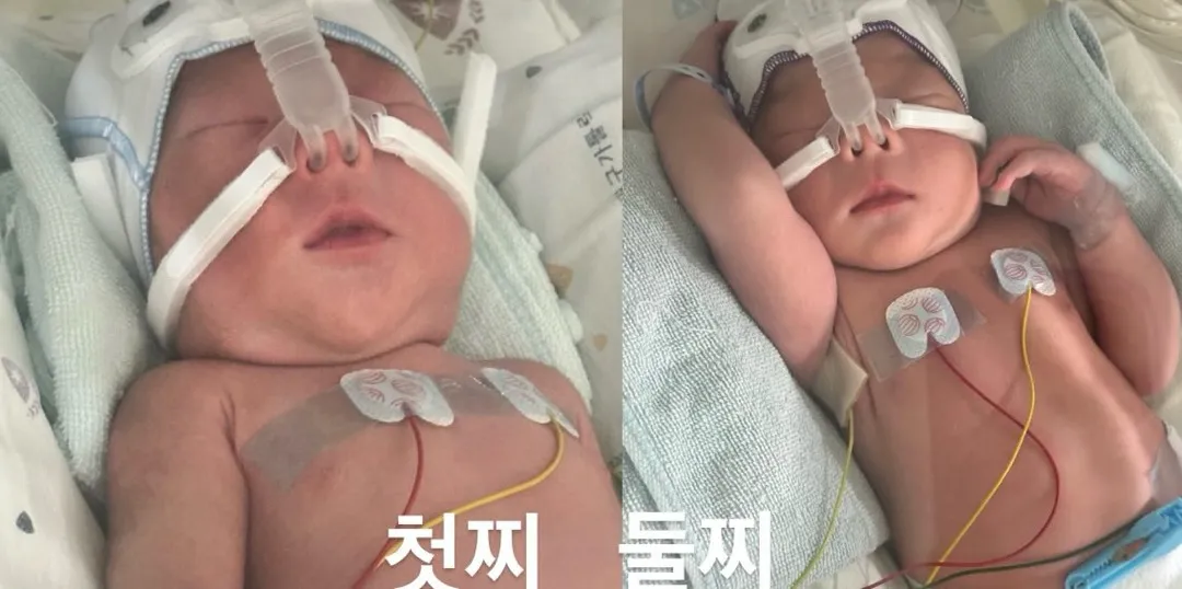 금둥이네 출산했어요! 아기들은 니큐로 들어갔어요ㅠ