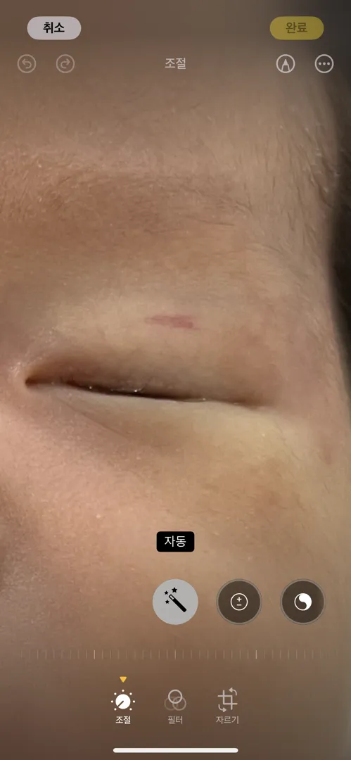애기 눈위에 빨갛게 올라왔는데 뭘까요??