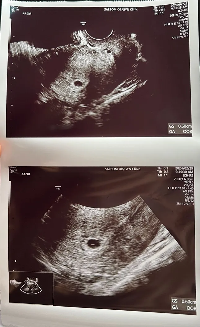 아기집이랑 보고 왔어요~!!