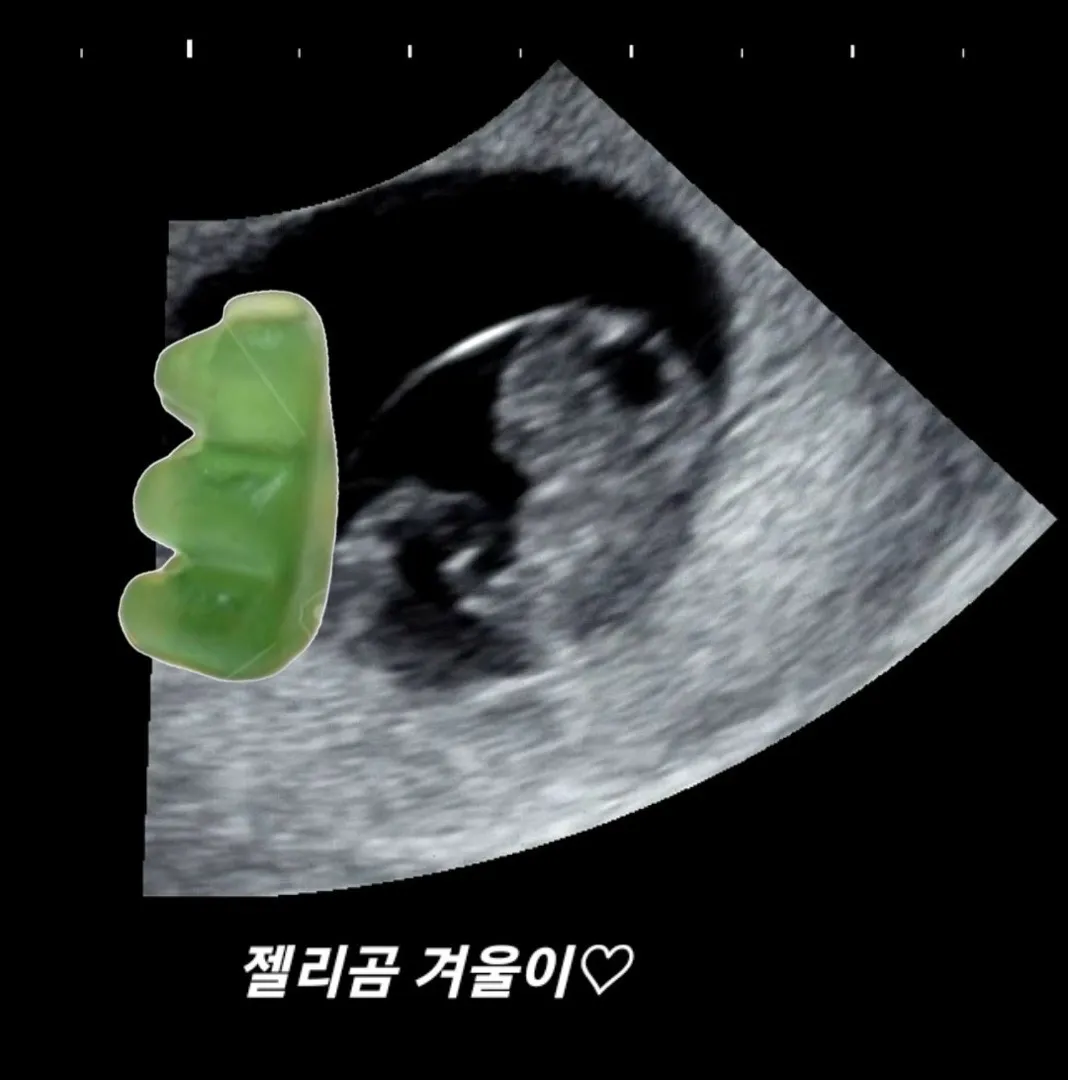 8주에 째그마한 이등신 젤리곰 봤어요 ㅎㅎㅎ