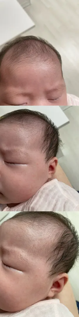 태열? 트러블?