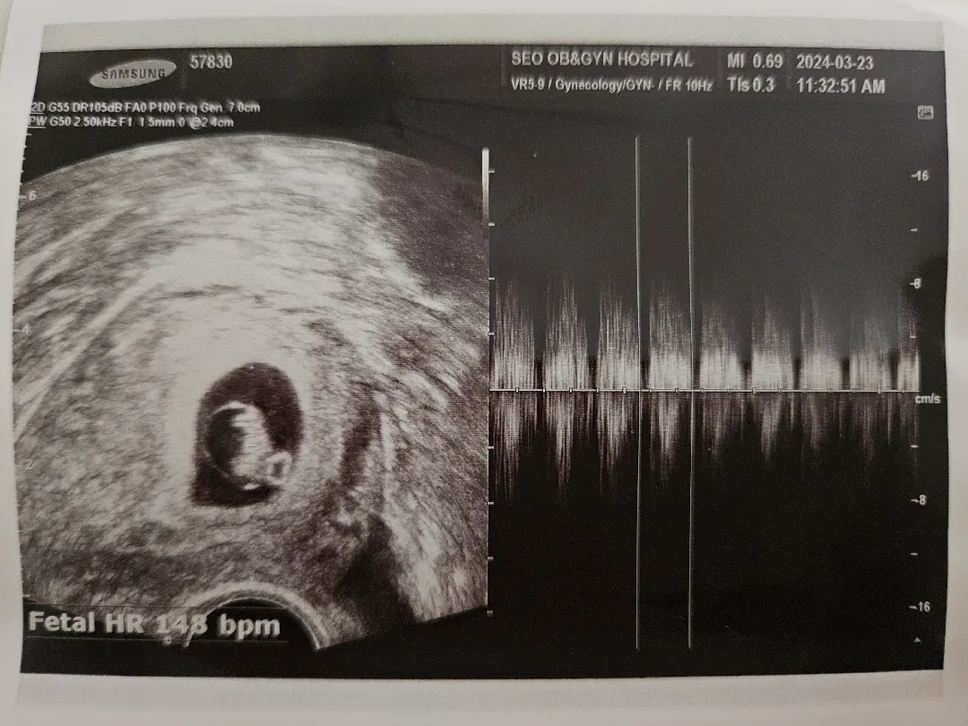 7주차 병원다녀왔어요!